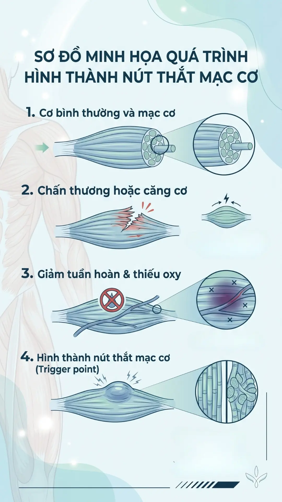 Massage giảm căng cơ gi&uacute;p xả điểm Trigger Point